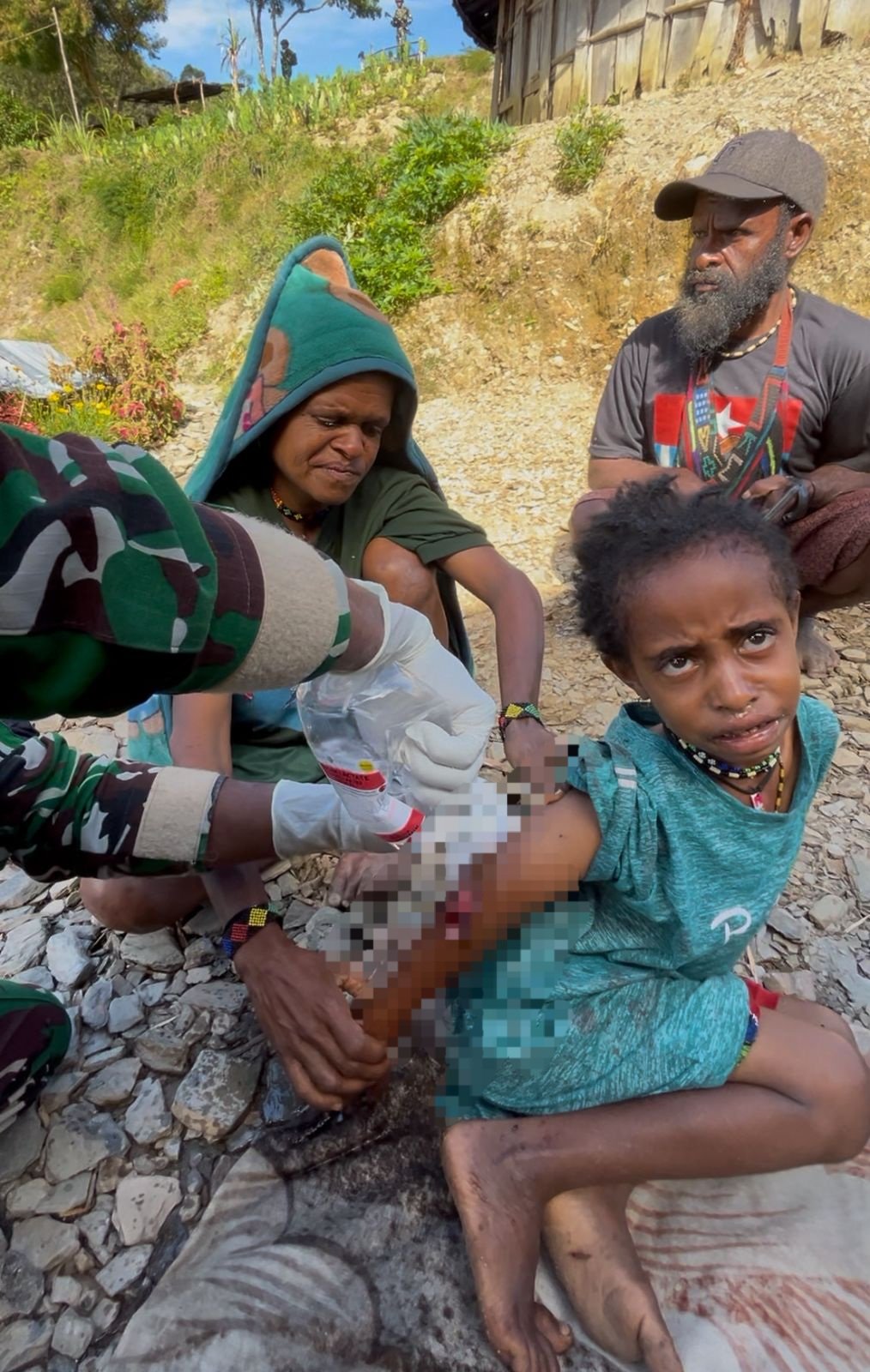 Prajurit Satgas Yonif 743/PSY memberikan pertolongan pertama pada anak korban penembakan OPM di Distrik Sinak Puncak Papua sebelum dievakuasi ke RS Mulia. - thewasesanews.com