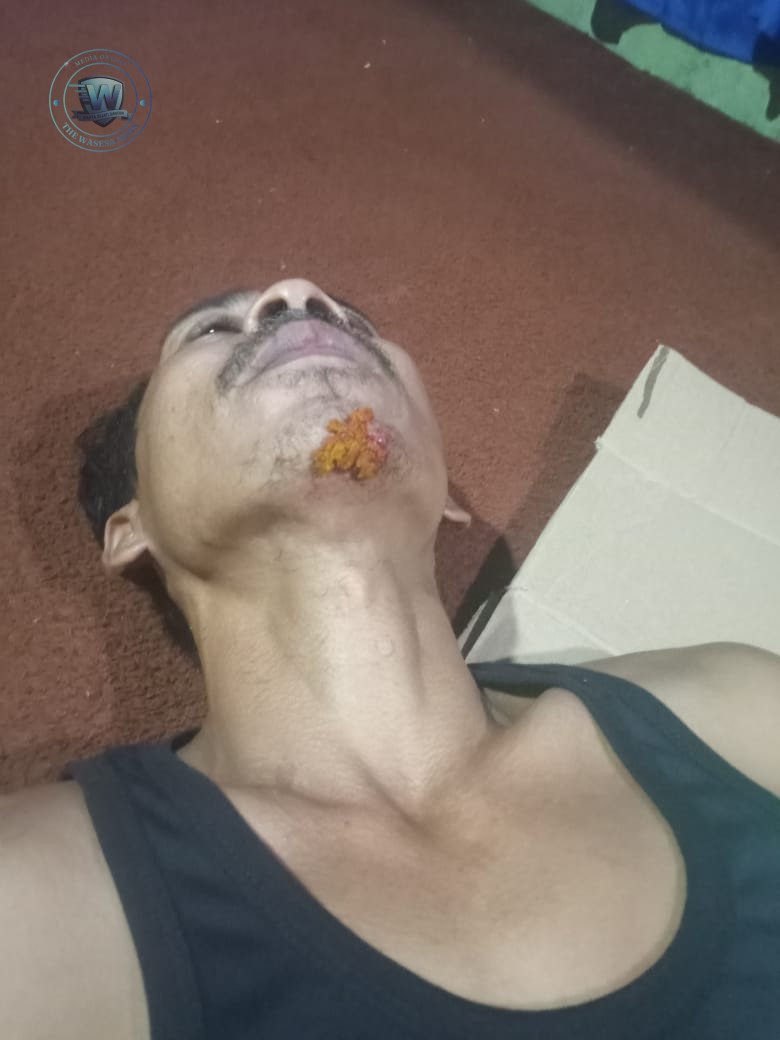 Galian Proyek Sumur-Panimbang Makan Korban, GWI Desak Pidana. - thewasesanews.com